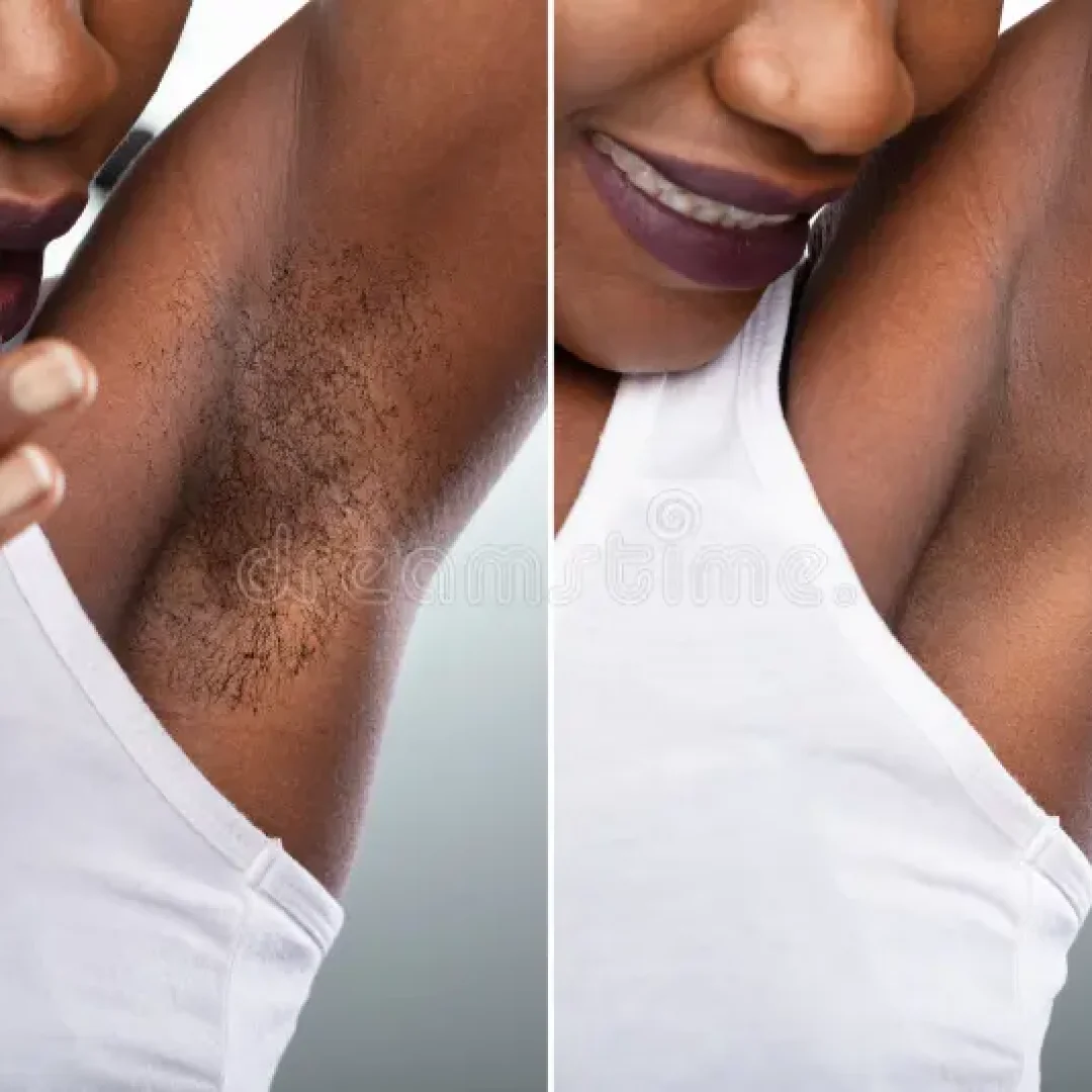 concept-underarm-hair-removal-concept-woman-s-underarm-hair-removal-grey-background-181439737